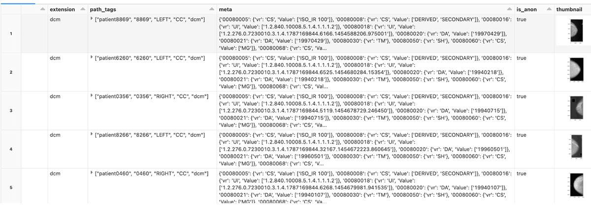 Display of file path, file metadata, DICOM metadata, thumbnail